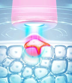 FOREO ESPADA 2 Pearl Pink