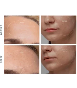 Hot KIWI Derma Gezichtsverzorgings Accessoires