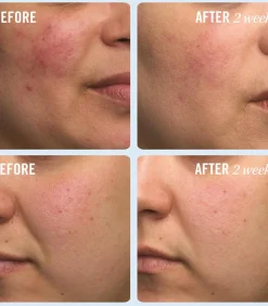 New Ultra Repair Cream Intense Repair - 170 ml Bodylotions & Bodymilks